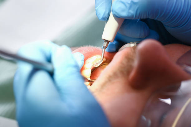 Best Emergency Tooth Extraction in Weidman, MI